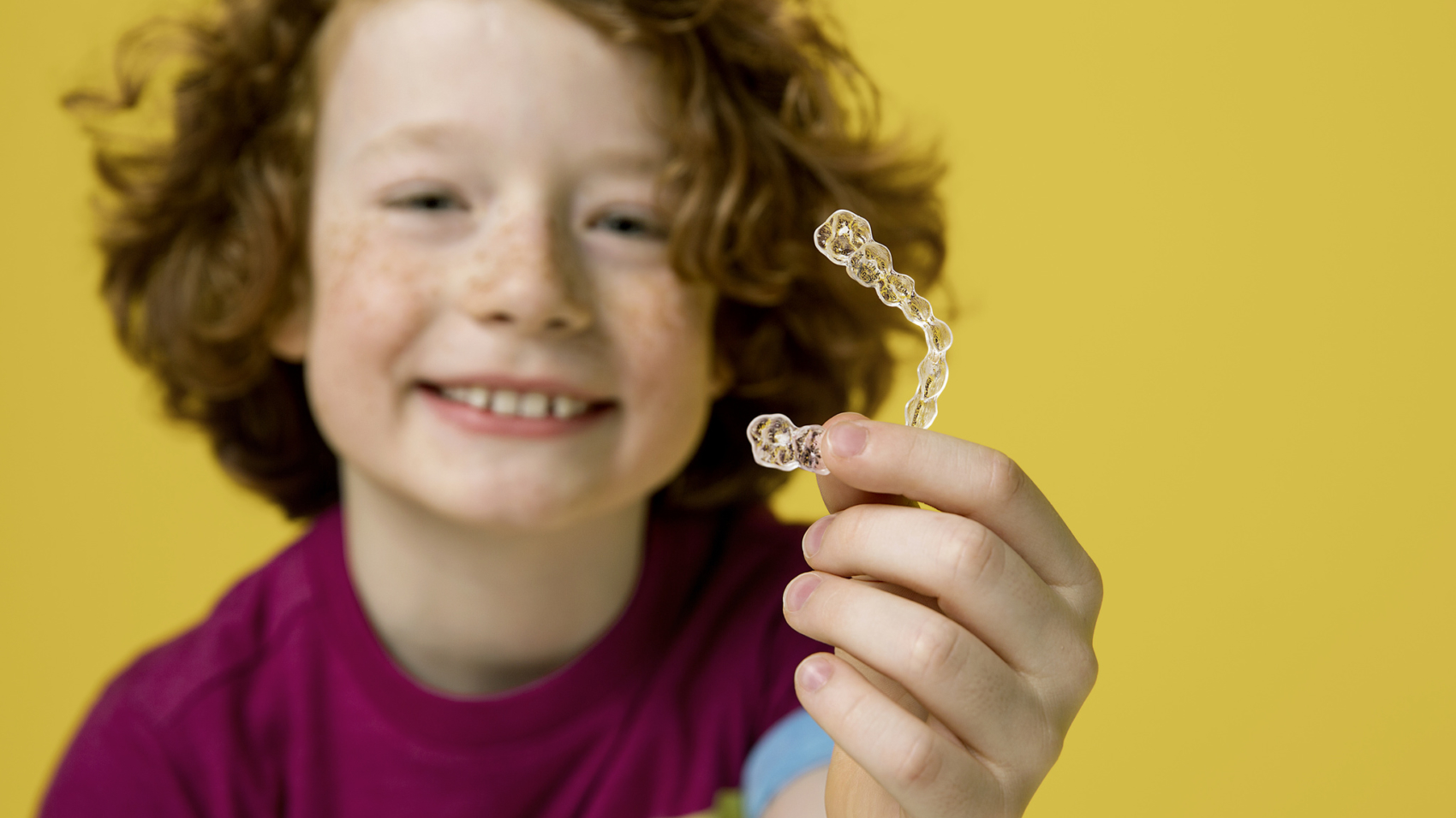 Conheça o Invisalign First - feito para crianças a partir dos 6 anos -  Hiroce Ortodontia e Estética